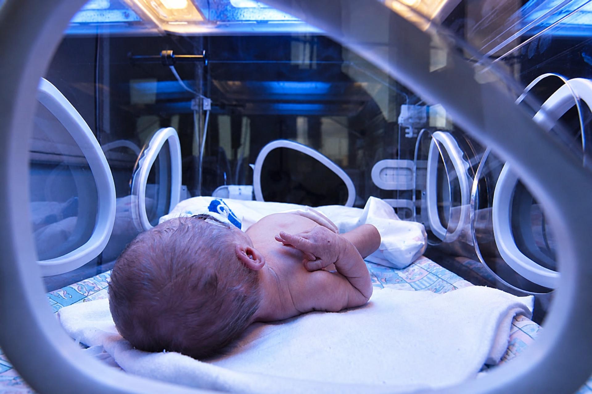 نوزاد تازه متولد شده درون دستگاه انکوباتور (Incubator) در بخش مراقبت‌های ویژه